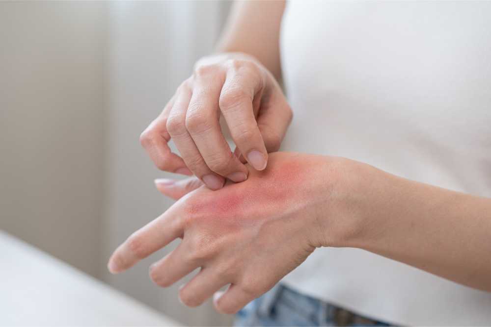 Sữa tắm dịu nhẹ giúp giảm ngứa, kháng khuẩn và phục hồi làn da bị nấm da tay.